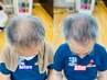 【新大久保】増 毛 エクステ【前髪が少ないのが気になる人向け】４00本コース