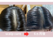 ピーチグリーン 横浜(Peach green)の雰囲気（しっかり結果が出る育毛促進スカルプケア！）