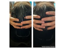 シェヴー(Cheveux)の雰囲気（頭筋スパ★しっかり結果がでますよ！スッキリ感半端ないです★）