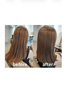 エイジングケア