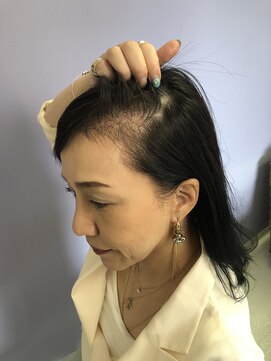 グレースフィオーレ 苫小牧店 グレースグロウセラピー