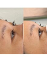 スイ(SUI)&nbsp;まつげパーマ