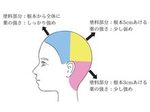 【事例2：頭の部分によってクセの強さが違う方の場合】