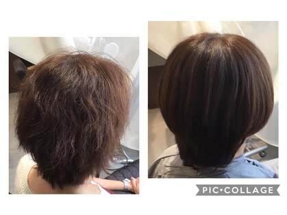 ヘアークリニックAGの写真