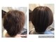 ヘアークリニックAGの写真