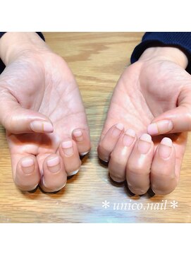 ウニコ(unico) スクエアフレンチ