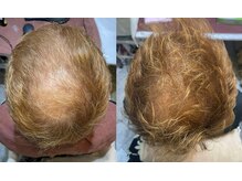 エクソソーム サロン(ex salon)の雰囲気（業界初のエクソソームの頭皮ケアは、健やかな髪の毛に導きます。）