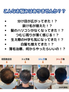 ジーナハーバー(JEANA HARBOR) ヒト幹細胞頭皮ケア!薬に頼らない新施術!