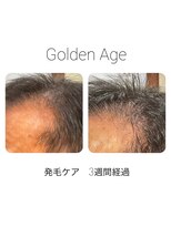 ゴールデンエイジ(Golden Age)&nbsp;【　発　毛　ケ　ア　３　週　間】