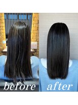 ゼン(ZEN 禅)&nbsp;矯正