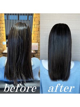 ゼン(ZEN 禅) 矯正