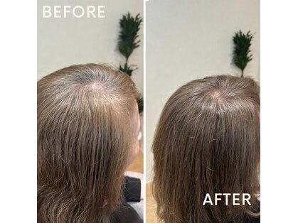 マーキア(Maackia)の写真