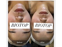 ビオトープ(BIOTOP)の雰囲気（筋膜リリースフェイシャル！お顔の歪みは体の不調につながります）