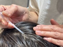 ヒト幹細胞培養液を塗布