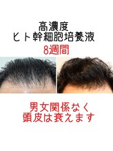 地肌が見える、ボリューム、アホ毛が気になったら、、、頭皮は衰えます！ヘアスタイル、髪質改善は頭皮から