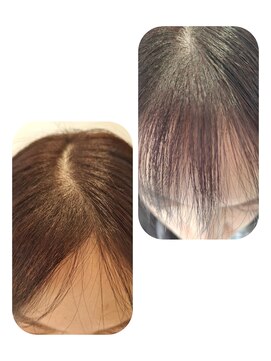 ユーフォルムギンザ(y-Forme Ginza) 話題のトキカタ♪前髪編