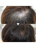 【最近分け目が気になる方へ】抜け毛・細毛改善コース
