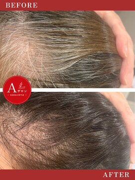 エーサロン(Aサロン) 根元染め/白髪染め