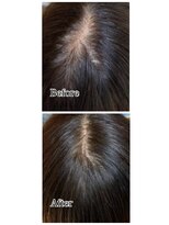 なご美ヘアー(なご美hair)&nbsp;リペアで分け目を自然にカバー