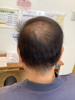 ツヤイロ 上飯田南店(TSUYA_IRO)&nbsp;5レベル   グレーブラウン