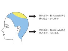 【事例3：全体的にクセが強い方の場合】