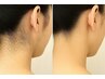 【うなじ】自分では見えない部分だからこそ！光脱毛付きのカットメニュー♪