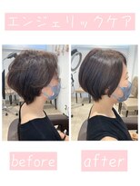 ストップアリトル(stop a little)&nbsp;エンジェリックケア