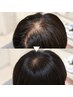 【最近分け目が気になる方へ】抜け毛・細毛改善コース