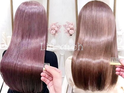 リルアーチ(Lillarch)の写真