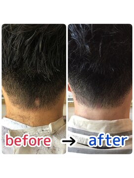 ブルーフィン シセロ(Blue Fin cicero) 頭皮改善！育毛促進ケア！