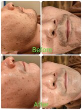 【根本的な改善には継続を】まずは半年～１年続けていきましょう。