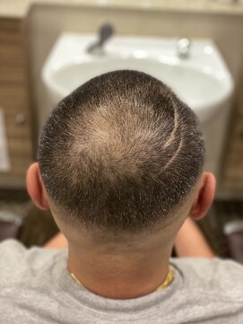 銀座マツナガ 浅草店 ATSUSHI風クロスラインハイスキンフェードボウズ超短髪！