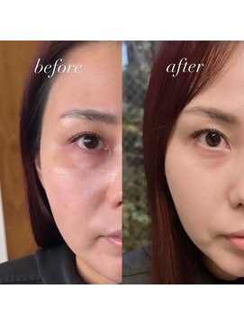 ラビリンス(Labyrinth) ヘッドスパ/髪質改善/トリートメント/強髪/リフトアップ