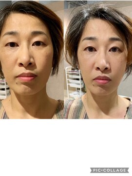 アクティフ(actif) 【大口式筋膜ヘッドスパ】名古屋の美容室actif 頭皮改善/ MJ有紀