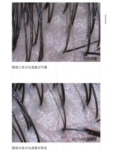 [活泡泉]自宅では出来ない頭皮ケアと心地良いシャンプー体験を