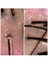 頭皮のメンテナンスも、オスカーにお任せ♪《本格スカルプスパ》