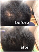 ヘアーサロン モカ(Hair salon MOKA) 増毛エクステ