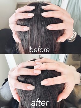 ユブ 根津(yubu)の写真/【頭蓋骨調整ヘッドスパ】リフレッシュだけじゃない！骨から調整して根本的な解決でお肌にも◎[上野]