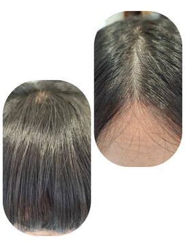 ユーフォルムギンザ(y-Forme Ginza) 話題のトキカタ♪前髪編