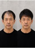 髪質改善トリートメントベージュ　ヘアアレンジ　シールエクステ