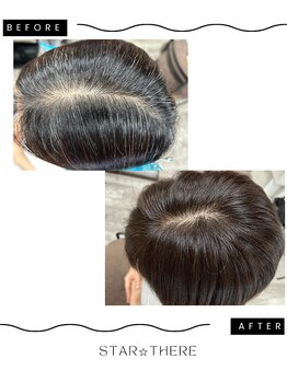 パーソナルの写真/育毛促進や白髪をケアする髪質改善。相談しにくい悩みも安心◎女性の私が担当★