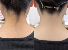 ヘアーデザイン キレイ(HAIR DESIGN Kirei)の雰囲気(【ネープケア】カラーやカットとご一緒に!同日施術可能です◎)