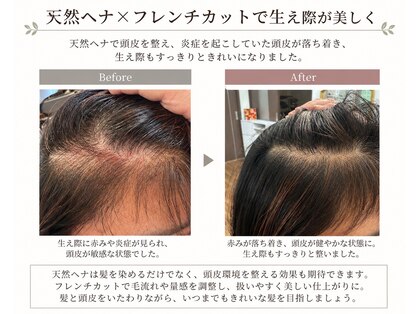 ピュアリーピュアリ(Purely-Purely)の写真
