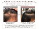 ピュアリーピュアリ(Purely-Purely)の写真