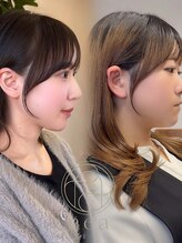 ネア(nea)