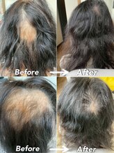 美容室タッチアップ 育毛促進