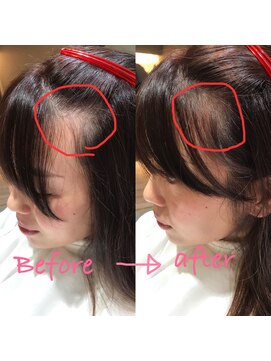 グレース(GRACE) カバーリングカット担当 みやもと