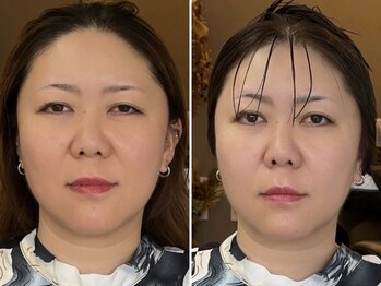 オダンゴヘアー(odango hair)の写真/当店オススメメニュー【骨格補正スパ】癒しだけではなく、頭皮をもみほぐし、心身ともにスッキリと*