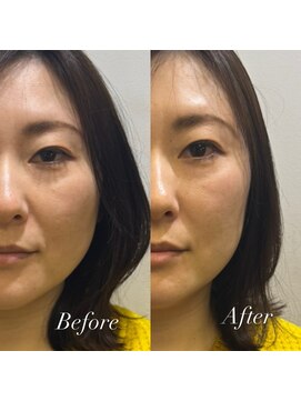 ラビリンス(Labyrinth) ヘッドスパ/髪質改善/トリートメント/強髪