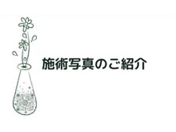 きよらビューティーラウンジ(Kiyora BEAUTY LOUNGE)/施術のご案内[神保町]